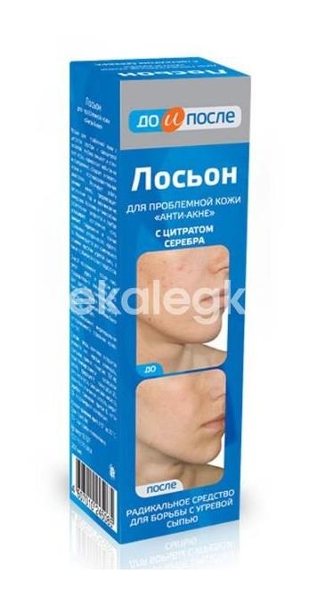 Изображение До и после лосьон анти - акне для пробл. кожи 200мл. /твинс тэк/ ДО И ПОСЛЕ ЛОСЬОН АНТИ - АКНЕ ДЛЯ ПРОБЛ. КОЖИ 200МЛ. /ТВИНС ТЭК/ ТВИНС ТЭК