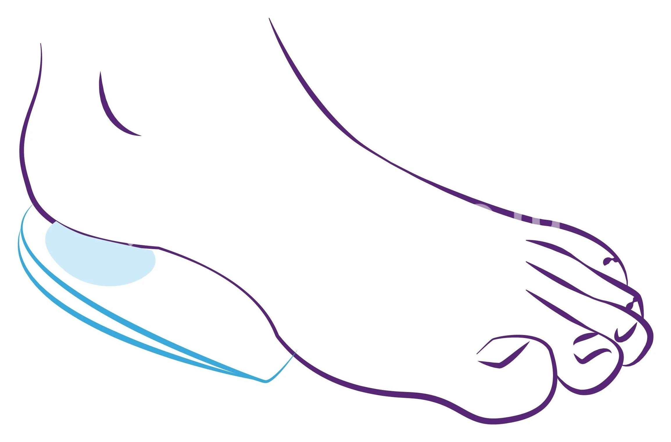 Тривес подпяточник силик. ст - 40 р.s (приспособл.разгруж.) Тривес подпяточник силик. ст - 40 р.s (приспособл.разгруж.) - 1