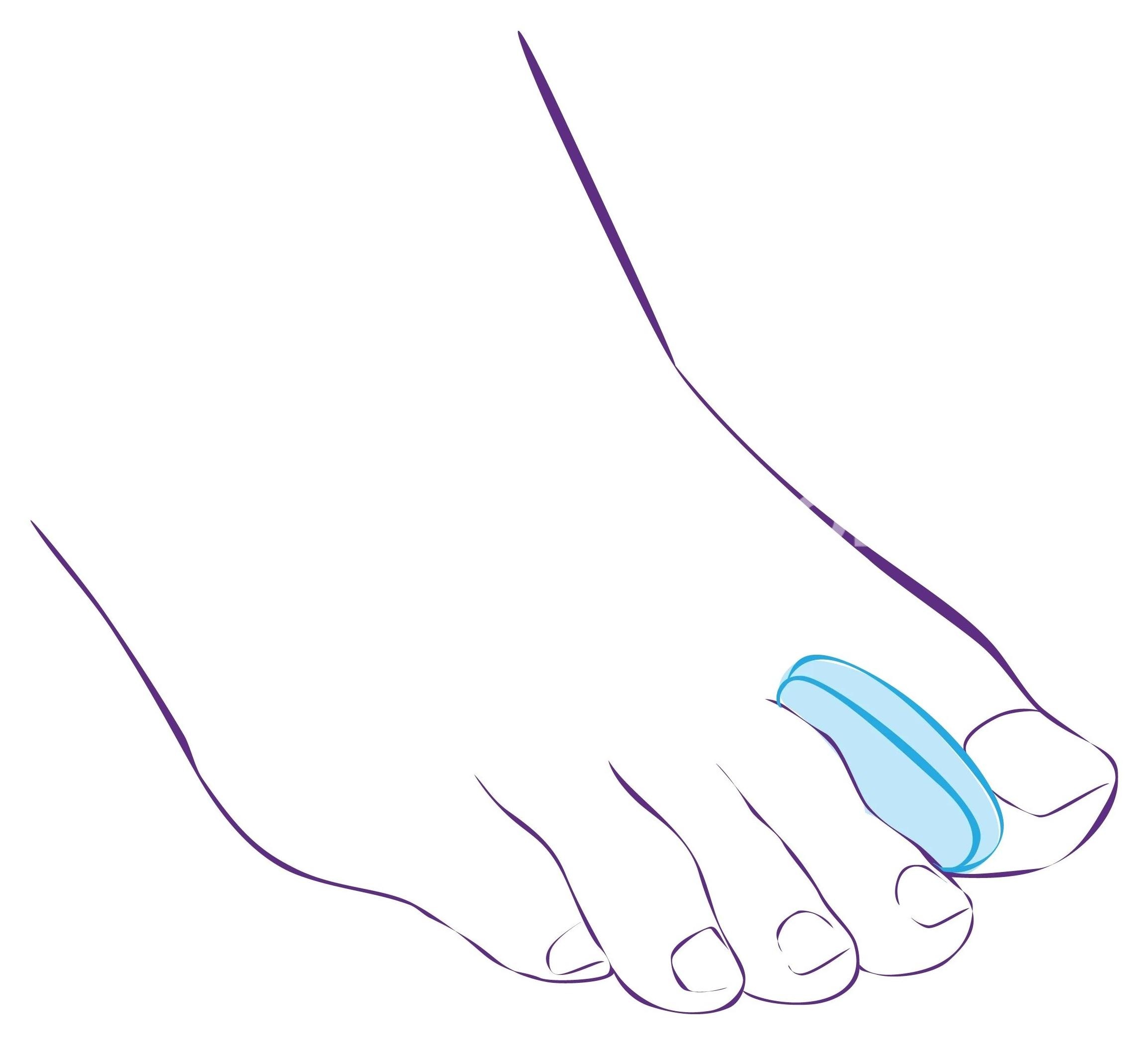 Тривес межпальцевый вкладыш р.l /арт.ст - 32/ Тривес межпальцевый вкладыш р.l /арт.ст - 32/ - 1