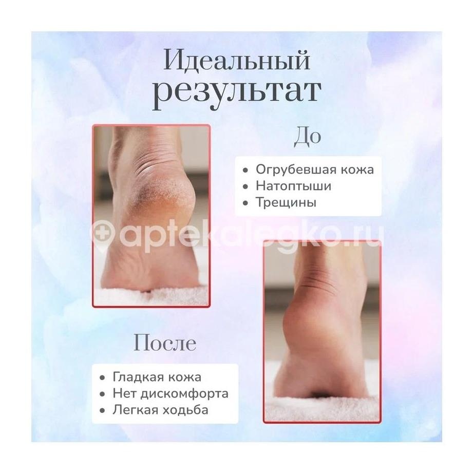 Изображение Solinberg терка двухстороняя для ног /261 - 2713/ SOLINBERG ТЕРКА ДВУХСТОРОНЯЯ ДЛЯ НОГ /261 - 2713/ BERG-STAHLWAREN