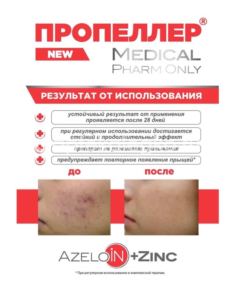 Пропеллер лосьон дерматологический азелоин + цинк 210мл Пропеллер лосьон дерматологический азелоин + цинк 210мл - 7