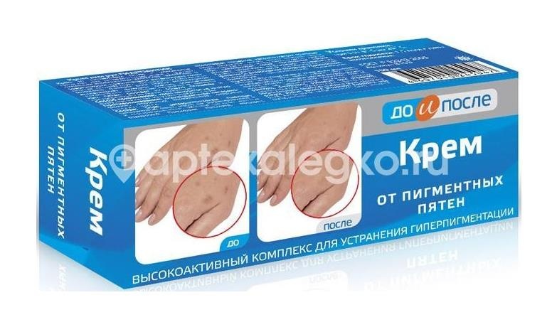 Изображение До и после крем п/пигментн. пятен 50мл. /твинс тэк/ ДО И ПОСЛЕ КРЕМ П/ПИГМЕНТН. ПЯТЕН 50МЛ. /ТВИНС ТЭК/ ТВИНС ТЭК